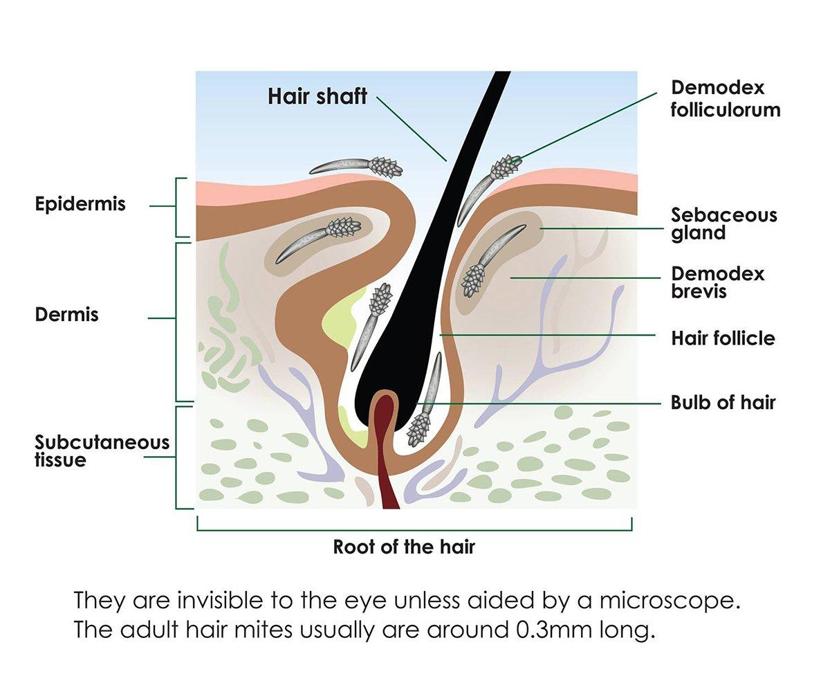 Tungau Demodex di Tubuh Manusia